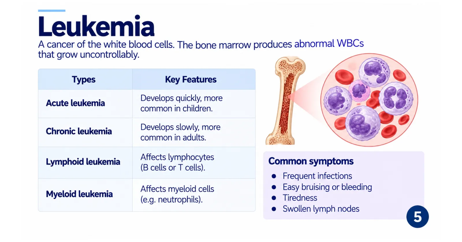 Leukaemia: table of acute, chronic, lymphoid and myeloid leukaemia with key features, and common symptoms such as frequent infections and easy bruising