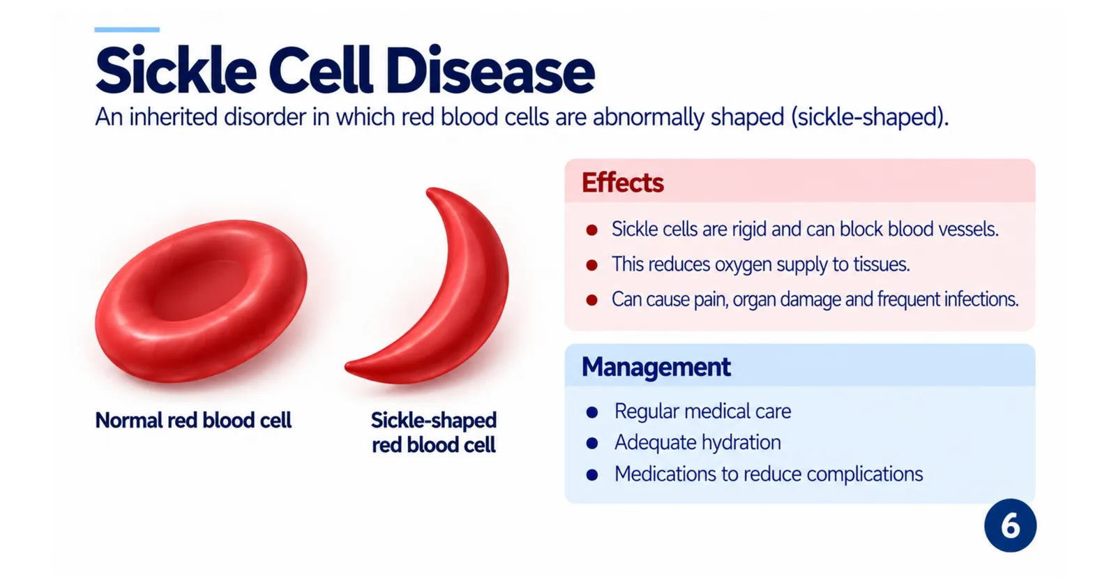 Sickle cell disease: a normal disc-shaped red blood cell beside a rigid sickle-shaped cell, with its effects and management