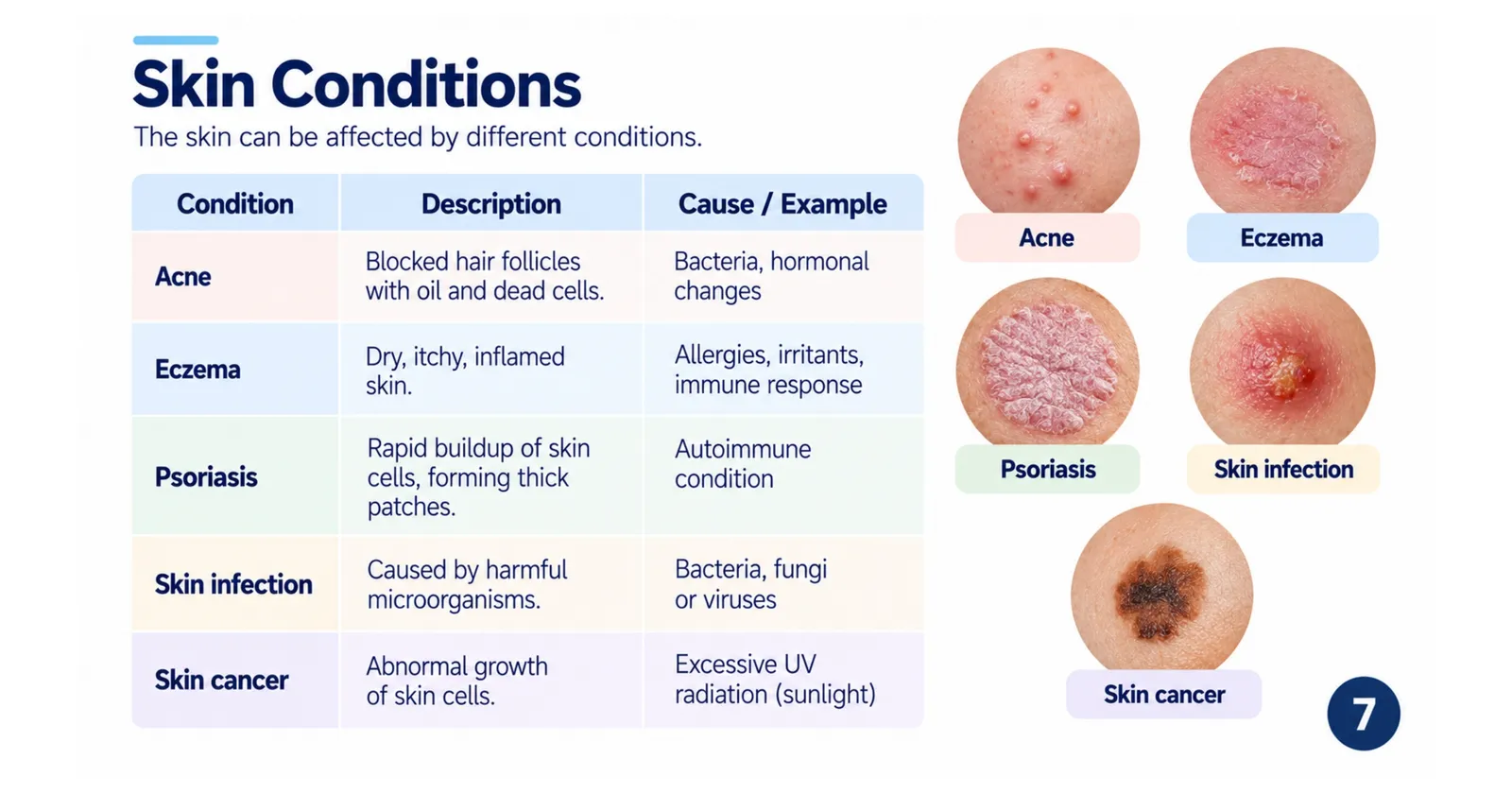 Common skin conditions with descriptions and causes: acne, eczema, psoriasis, skin infection and skin cancer