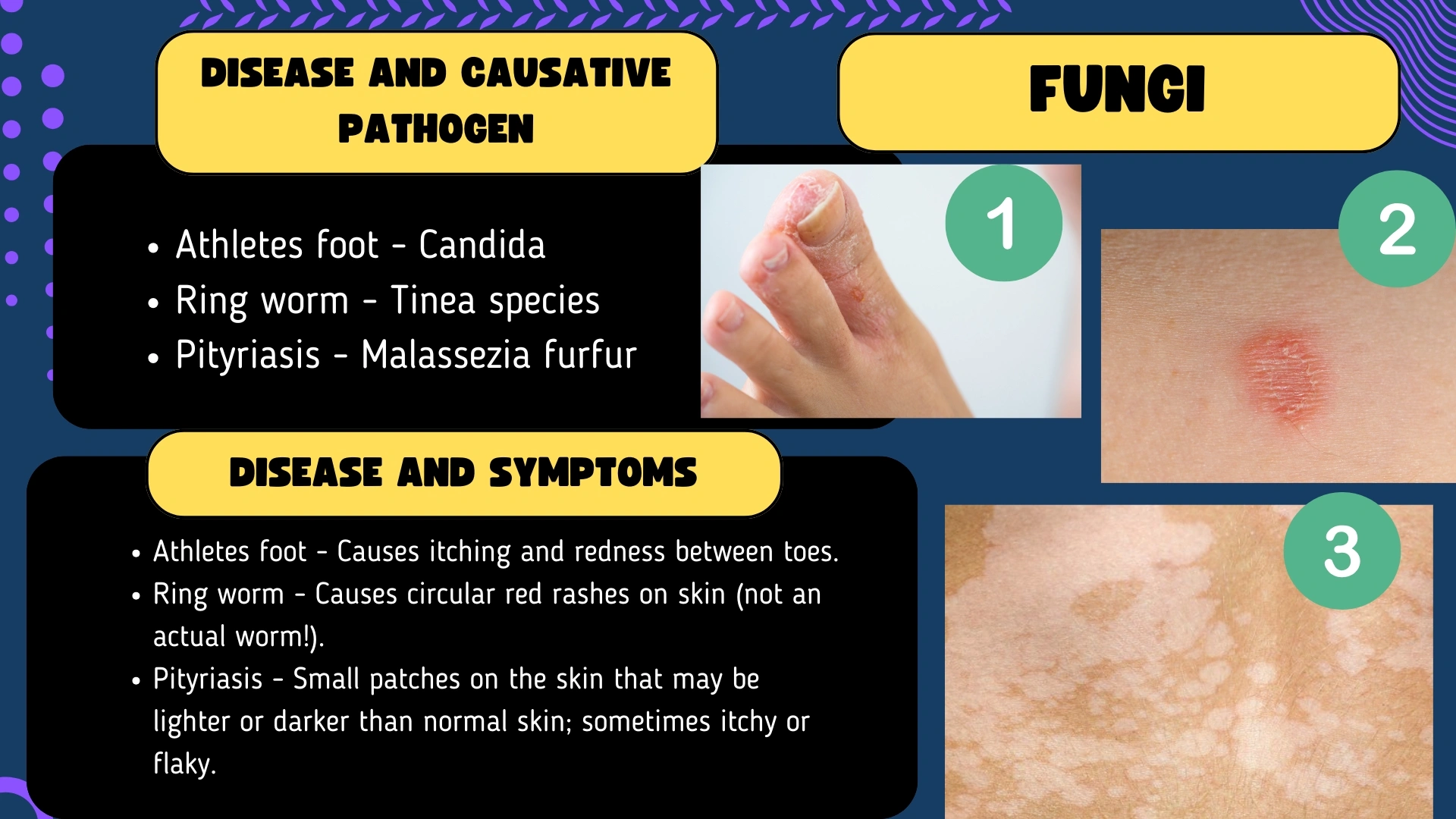 Fungi Diseases