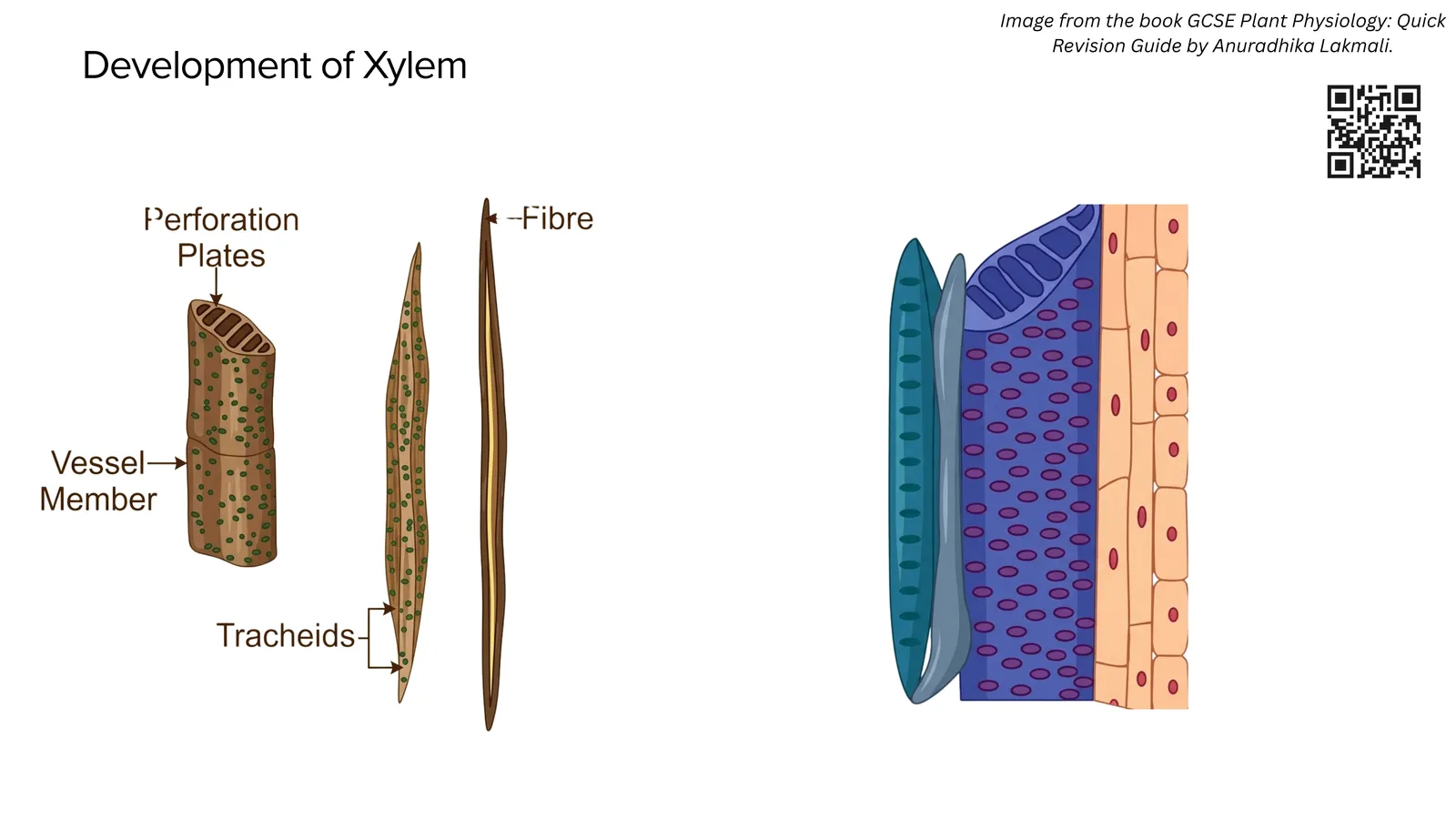 Development of xylem: a vessel member with perforation plates, a tracheid and a xylem fibre, with a drawing of xylem tissue